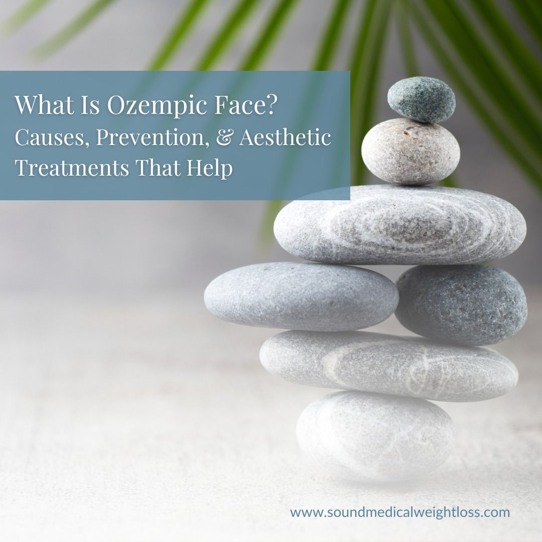 Stacked stones with text about Ozempic Face.